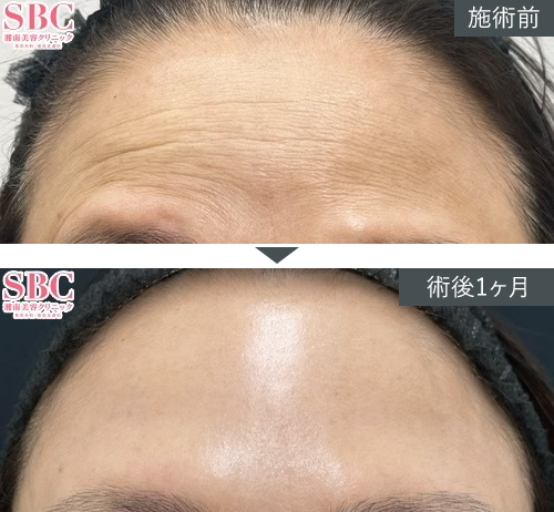 D~W+{gbNX~Ǘʐ^izjPICKUP2 Before After
