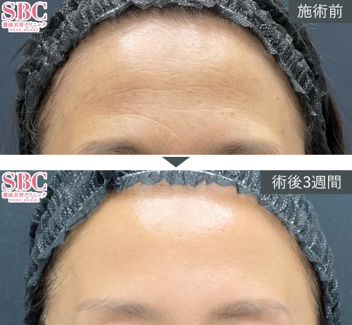 D~W+{gbNX~Ǘʐ^izjPICKUP3 Before After
