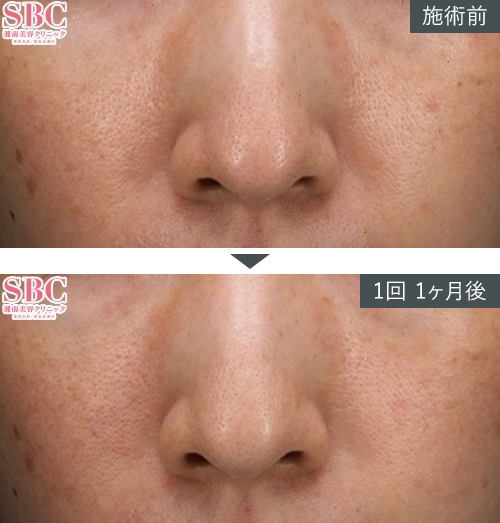 D~W+{gbNX~Ǘʐ^izjPICKUP3 Before After